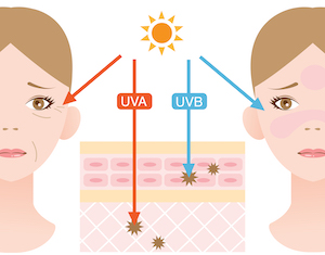 Sonnenlicht besteht aus UVA und UVB Strahlung